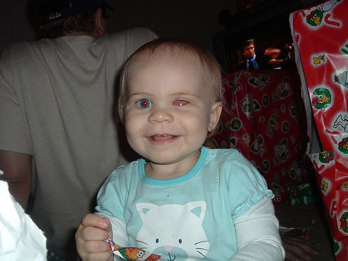Rowan smiling at Christmas shortly before getting her first prosthetic.