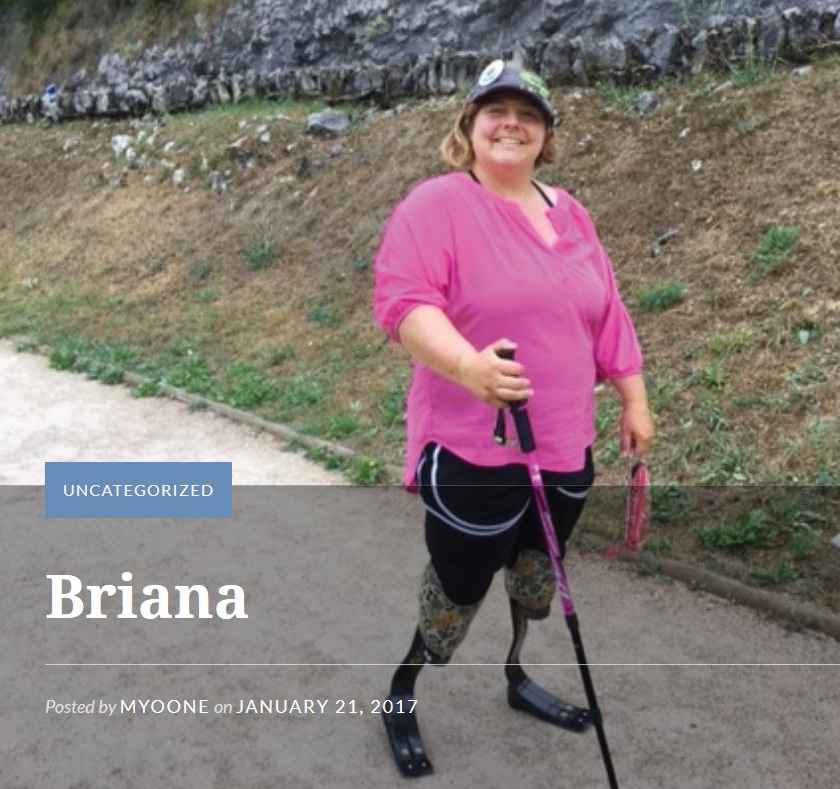 A photo shows a woman walking down a trail using a walking stick and two leg prosthetics.
