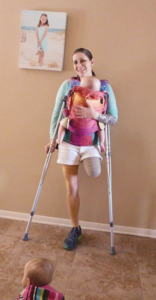 A photo shows a woman with one leg amputated. She is using crutches to support herself while holding a baby in a carrier on her chest.