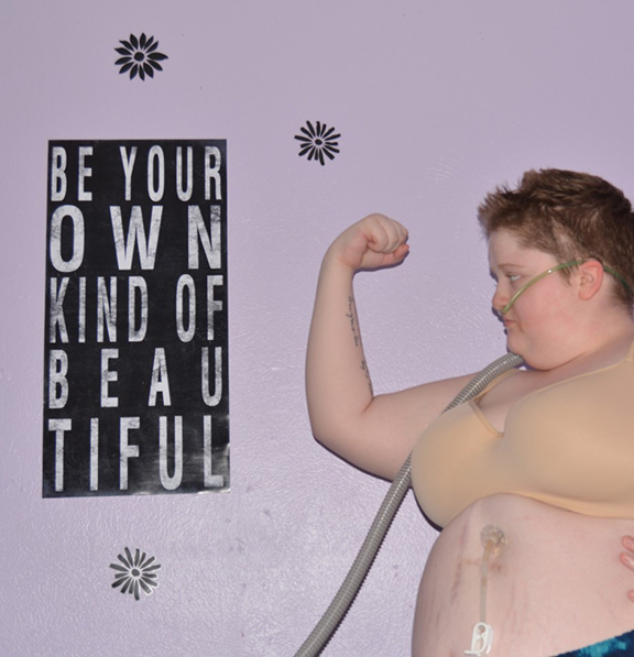 A photo shows a woman on a ventilator who is standing and flexing in front of a sign that reads: Be your own kind of beautiful.